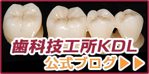 歯科技工所KDLブログ