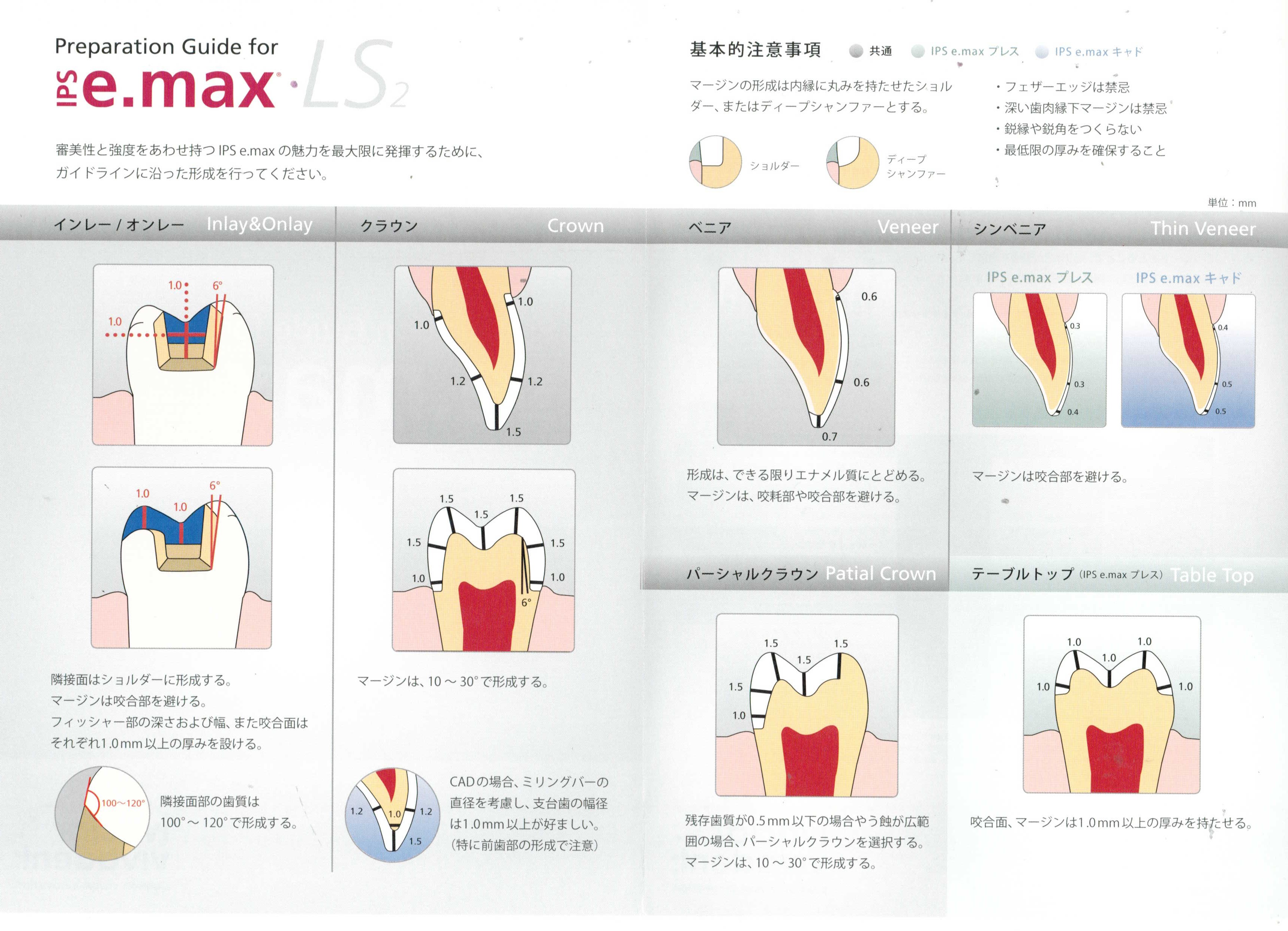 e.maxプレス オールセラミック｜歯科技工所KDL 神奈川県横浜市 全国対応