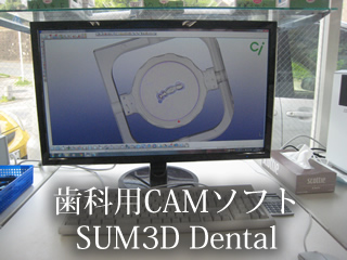 歯科用CADシステム